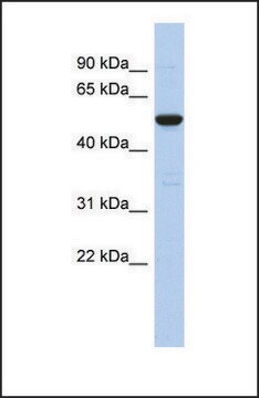 Anti-C9ORF75 antibody produced in rabbit affinity isolated antibody