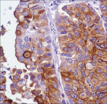 Anti-Uroplakin III antibody, Rabbit monoclonal clone SP73, recombinant, expressed in proprietary host, affinity isolated antibody