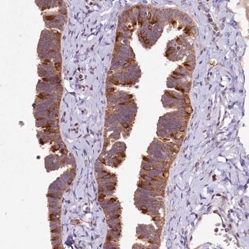 Anti-DYNC2H1 antibody produced in rabbit Prestige Antibodies&#174; Powered by Atlas Antibodies, affinity isolated antibody, buffered aqueous glycerol solution