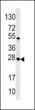 ANTI-CASA (CENTER) antibody produced in rabbit purified immunoglobulin, buffered aqueous solution