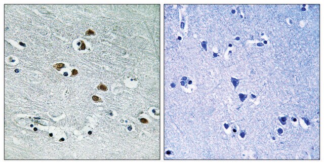 Anti-HDAC6 antibody produced in rabbit affinity isolated antibody