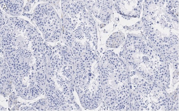 Anti-Ac-&#945;-Tubulin (Lys40) Antibody, clone 1L10, ZooMAb&#174; Rabbit Monoclonal recombinant, expressed in HEK 293 cells