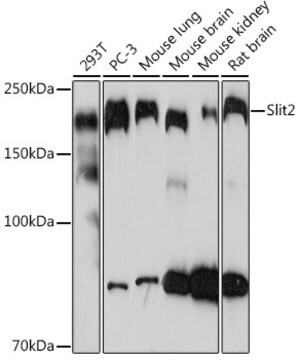 Anti-Slit2 Antibody, clone 1T5A3, Rabbit Monoclonal