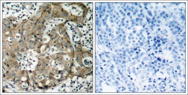 Anti-FOXO1 (Ab-319) antibody produced in rabbit affinity isolated antibody