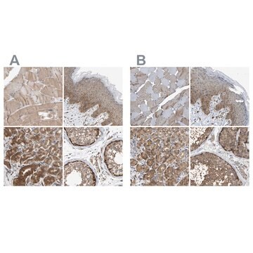 Anti-GCN1 antibody produced in rabbit Prestige Antibodies&#174; Powered by Atlas Antibodies, affinity isolated antibody, buffered aqueous glycerol solution, Ab2