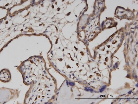 Monoclonal Anti-ATP6V1A, (C-terminal) antibody produced in mouse clone 4F5, purified immunoglobulin, buffered aqueous solution