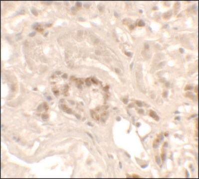 Anti-KANK1 antibody produced in rabbit affinity isolated antibody, buffered aqueous solution