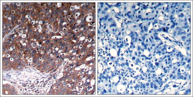 Anti-IGF1R (Ab-1280) antibody produced in rabbit affinity isolated antibody