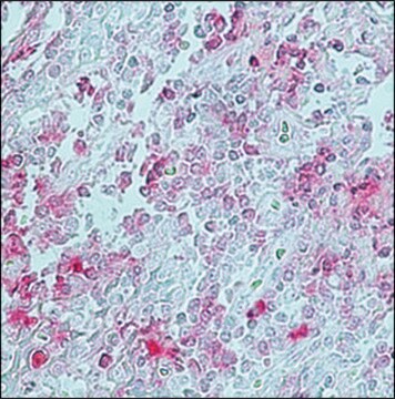 モノクロナール抗ウサギIgG (&#947;-鎖特異的) clone RG-96, purified immunoglobulin, buffered aqueous glycerol solution