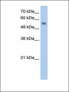 Anti-UGT3A2 antibody produced in rabbit IgG fraction of antiserum