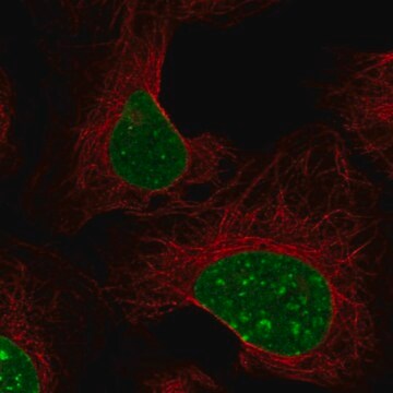 Anti-Cbx1 Antibody Produced In Rabbit Prestige Antibodies&#174; Powered by Atlas Antibodies, affinity isolated antibody, buffered aqueous glycerol solution