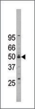 Anti-NOC2L (center) antibody produced in rabbit IgG fraction of antiserum, buffered aqueous solution