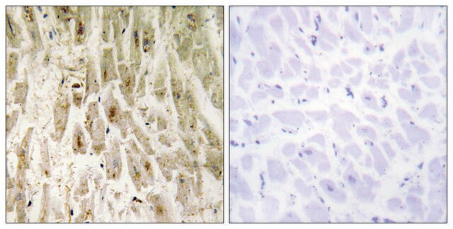 Anti-SMAD1 antibody produced in rabbit affinity isolated antibody