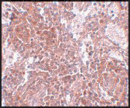 Anti-TSPAN9 antibody produced in rabbit affinity isolated antibody, buffered aqueous solution