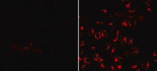 BioTracker 555 UV-Excitation Red Lysosome Dye Live cell imaging dye for acidic cellular organelles such as lysosomes.