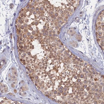 Anti-WDR59 antibody produced in rabbit Prestige Antibodies&#174; Powered by Atlas Antibodies, affinity isolated antibody, buffered aqueous glycerol solution