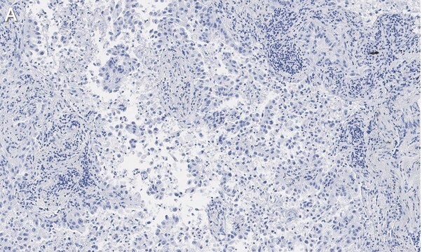 Anti-Integrin &#945;V&#946;5 Antibody, clone EM09902 , ZooMAb&#174; Rabbit Monoclonal recombinant, expressed in HEK 293 cells