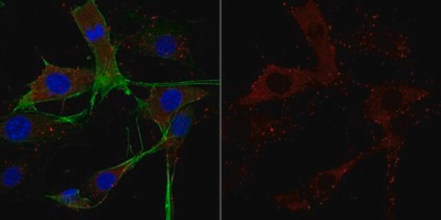 Anti-Cofilin-1 Antibody from rabbit, purified by affinity chromatography