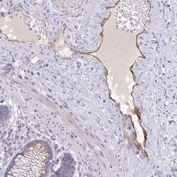 Anti-ABHD16A antibody produced in rabbit Prestige Antibodies&#174; Powered by Atlas Antibodies, affinity isolated antibody, buffered aqueous glycerol solution