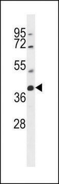 ANTI-SRD5A2L2 (C-TERM) antibody produced in rabbit IgG fraction of antiserum, buffered aqueous solution