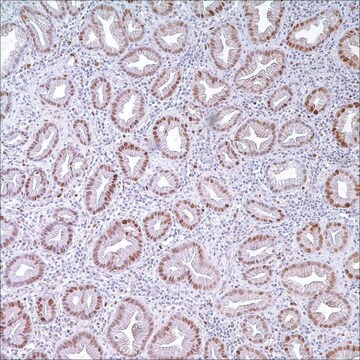 p21WAF1 (DCS-60.2) Mouse Monoclonal Antibody