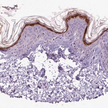 Anti-SLURP1 antibody produced in rabbit Prestige Antibodies&#174; Powered by Atlas Antibodies, affinity isolated antibody, buffered aqueous glycerol solution