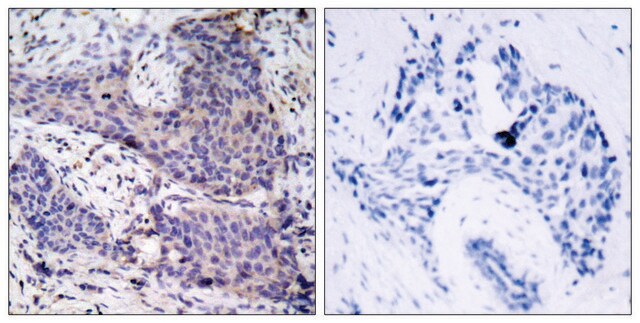 Anti-BAD antibody produced in rabbit affinity isolated antibody