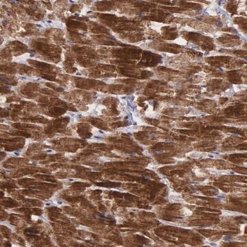 Anti-C22orf29 antibody produced in rabbit Ab1, Prestige Antibodies&#174; Powered by Atlas Antibodies, affinity isolated antibody, buffered aqueous glycerol solution