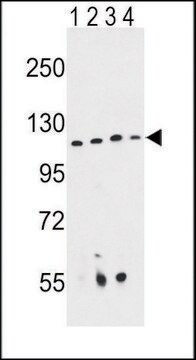 ANTI-RPGRIP1 (CENTER) antibody produced in rabbit IgG fraction of antiserum, buffered aqueous solution