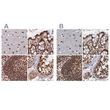 Anti-ZC3H18 antibody produced in rabbit Prestige Antibodies&#174; Powered by Atlas Antibodies, affinity isolated antibody, buffered aqueous glycerol solution