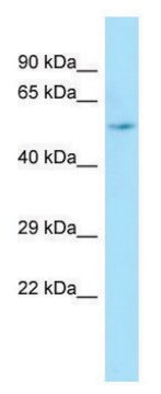 Anti-ARHGAP8 antibody produced in rabbit affinity isolated antibody