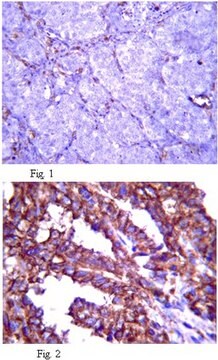 Anti-Fibrillin-2 Antibody, clone 48 clone 48, from mouse