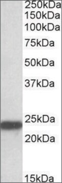 Anti-SOD2 antibody produced in goat affinity isolated antibody, buffered aqueous solution