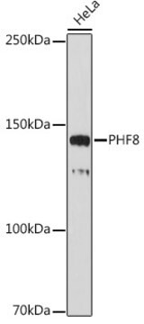 Anti-PHF8 Antibody, clone 2H9D4, Rabbit Monoclonal