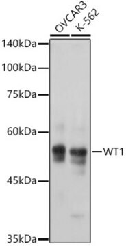 Anti-WT1 Antibody, clone 6L9X6, Rabbit Monoclonal