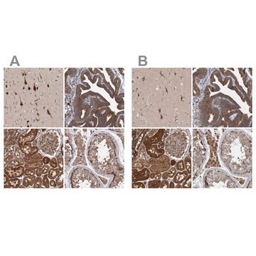 Anti-KIAA0753 antibody produced in rabbit Prestige Antibodies&#174; Powered by Atlas Antibodies, affinity isolated antibody, buffered aqueous glycerol solution, Ab1