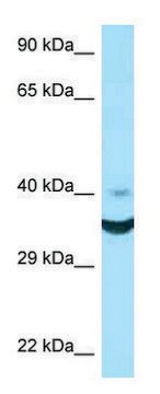 Anti-NCR1 (N-terminal) antibody produced in rabbit affinity isolated antibody