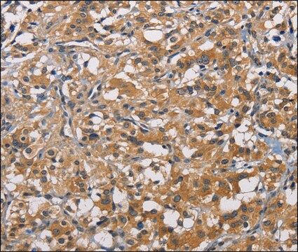 Anti-PIKFYV antibody produced in rabbit affinity isolated antibody