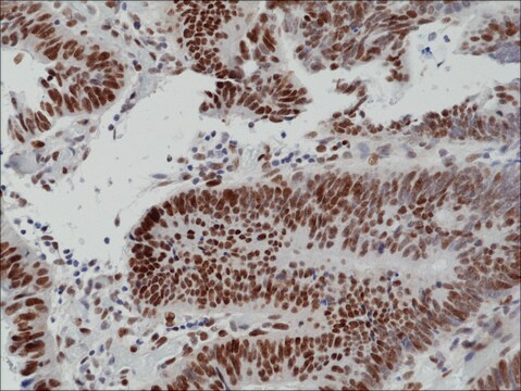 Anti-MSH6 antibody, Rabbit monoclonal recombinant, expressed in HEK 293 cells, clone RM376, purified immunoglobulin