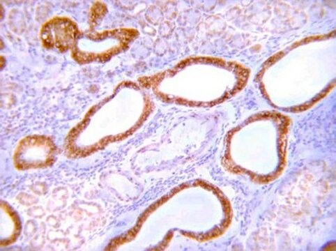 Anti-GLUT-4 Antibody, C-terminus from rabbit, purified by affinity chromatography