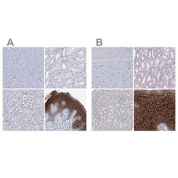 Anti-LYPD3 antibody produced in rabbit Prestige Antibodies&#174; Powered by Atlas Antibodies, affinity isolated antibody, buffered aqueous glycerol solution