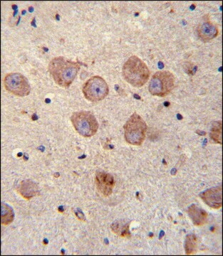 ANTI-FUSSEL18 (C-TERM) antibody produced in rabbit IgG fraction of antiserum, buffered aqueous solution