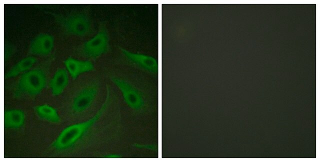 Anti-PLB antibody produced in rabbit affinity isolated antibody