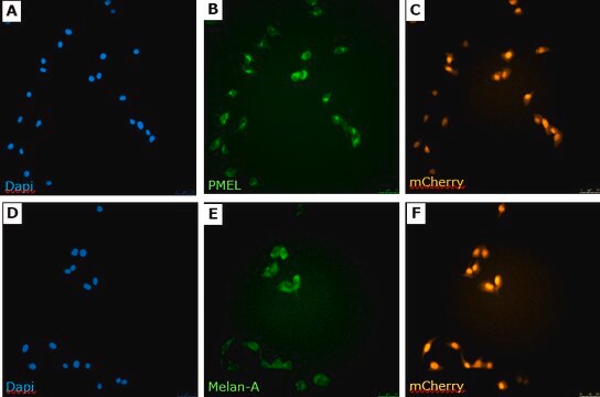 sLT-RMS Spontaneous Lung-tropic RET Melanoma-sorted Mouse Cell Line