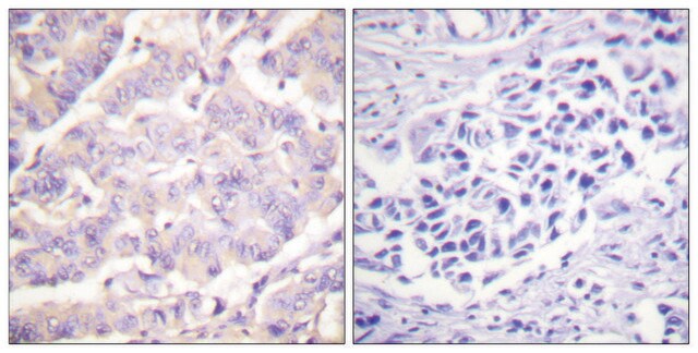 Anti-C-PLA2 antibody produced in rabbit affinity isolated antibody