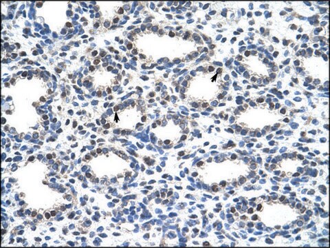 Anti-SMARCD2 antibody produced in rabbit affinity isolated antibody