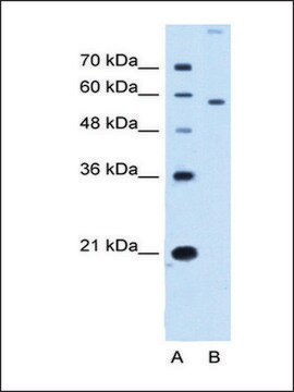 Anti-SLC22A2 IgG fraction of antiserum