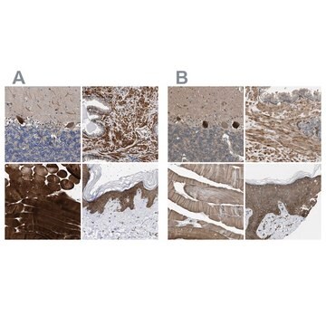 Anti-BAG3 antibody produced in rabbit Prestige Antibodies&#174; Powered by Atlas Antibodies, affinity isolated antibody, buffered aqueous glycerol solution, Ab1