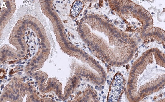 Anti-PTPN21 Antibody, clone 2K11 ZooMAb&#174; Rabbit Monoclonal recombinant, expressed in HEK 293 cells