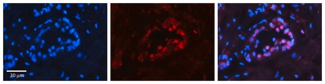 Anti-PAX8 antibody produced in rabbit affinity isolated antibody